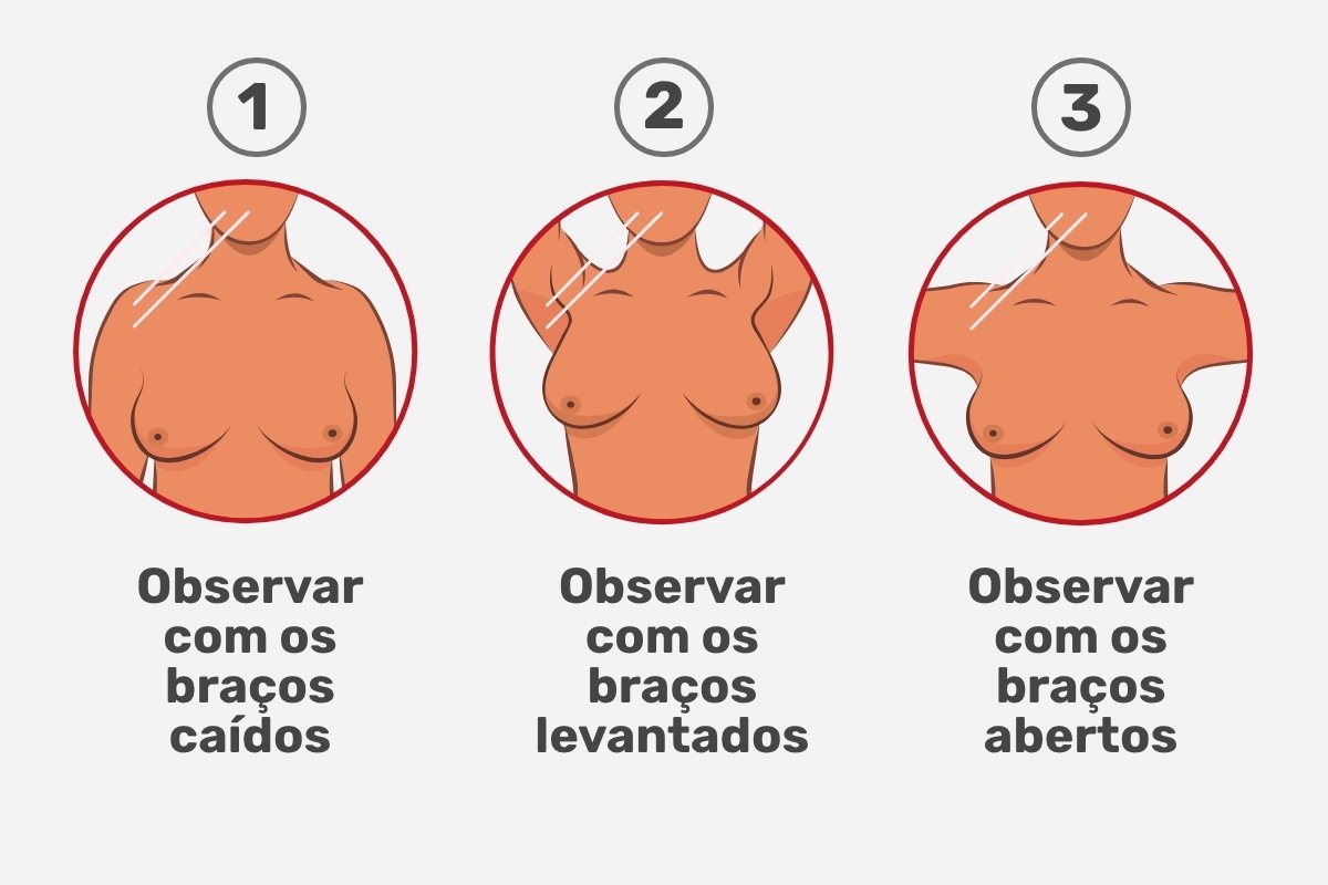 Cara melakukan pemeriksaan payudara sendiri (dan tanda peringatan)_0
