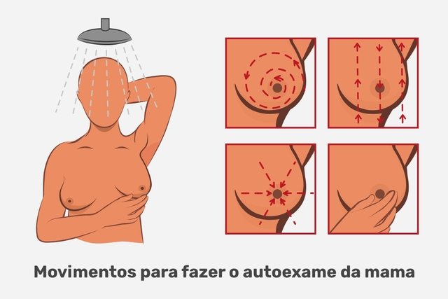Cara melakukan pemeriksaan payudara sendiri (dan tanda peringatan)_1