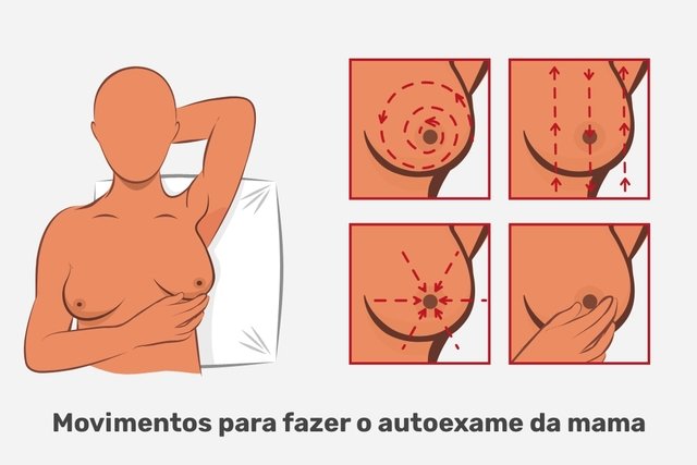 Cara melakukan pemeriksaan payudara sendiri (dan tanda peringatan)_2