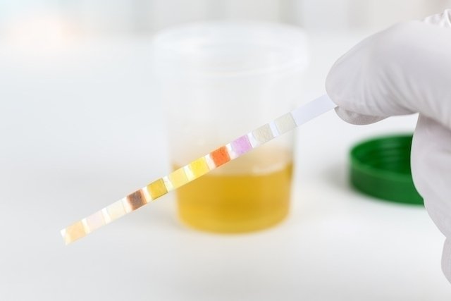 Badan keton dalam urin: penyebab, gejala, dan apa yang harus dilakukan_0