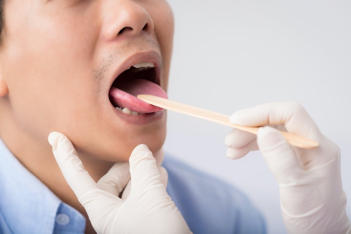 6 penyakit utama lidah dan cara mengobatinya_0