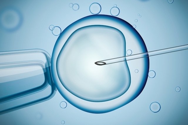Fertilisasi in vitro (IVF): apa itu, kapan diindikasikan dan bagaimana melakukannya_0