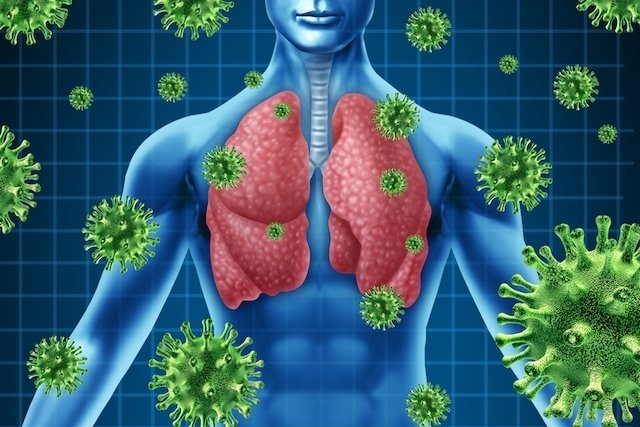 Infeksi paru-paru: apa itu, penyebab, jenis dan pengobatan_0