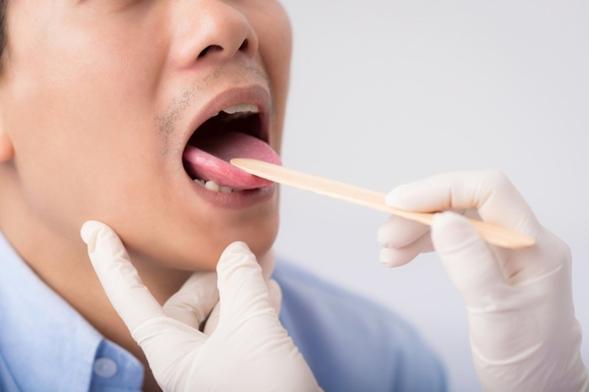 Mulut dan lidah mati rasa: 10 penyebab utama (dan apa yang harus dilakukan)_0