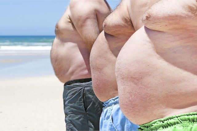 Obesitas: derajat, jenis, gejala, dan cara memastikannya_0