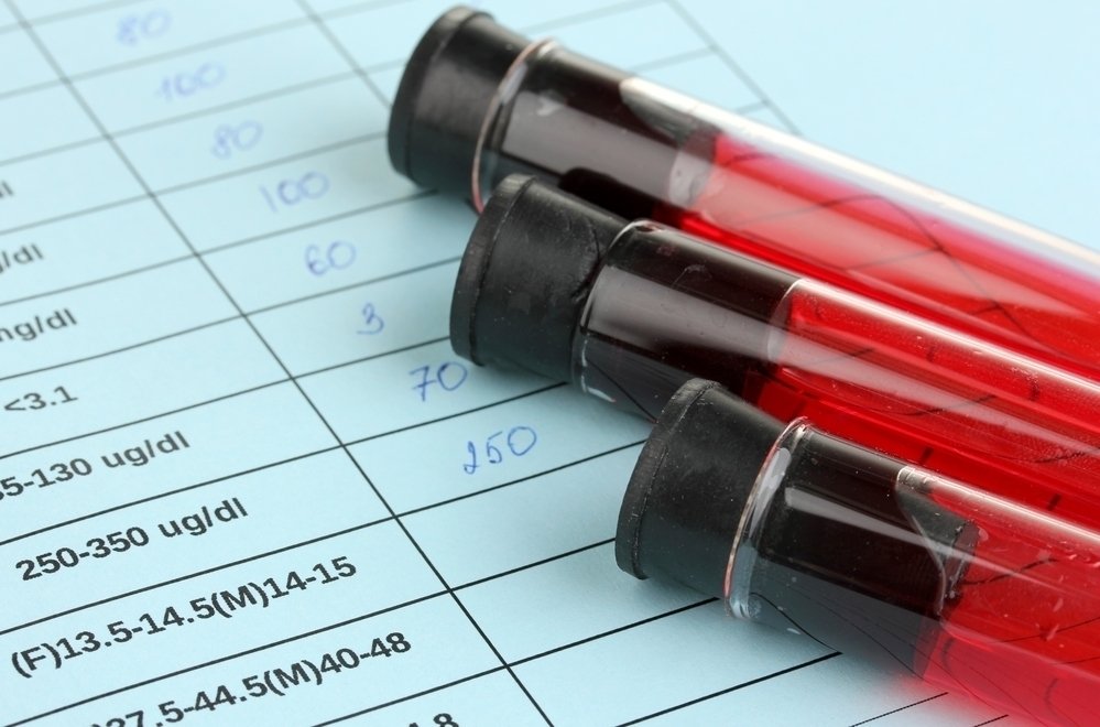pH darah: nilai normal, cara mengukur dan gejala_0