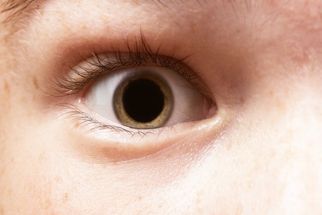 Pupil melebar: 7 penyebab utama dan apa yang harus dilakukan_0
