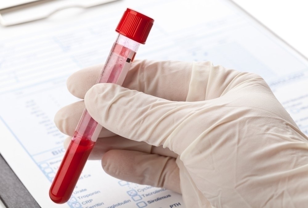 Tes kehamilan darah: apa tesnya dan kemungkinan hasilnya_0