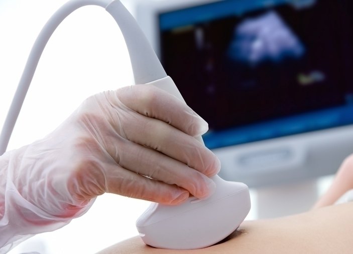 Ultrasonografi payudara: untuk apa, kapan melakukannya, dan hasilnya_0