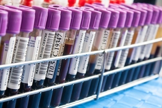 11 tes darah yang mendeteksi kanker_0