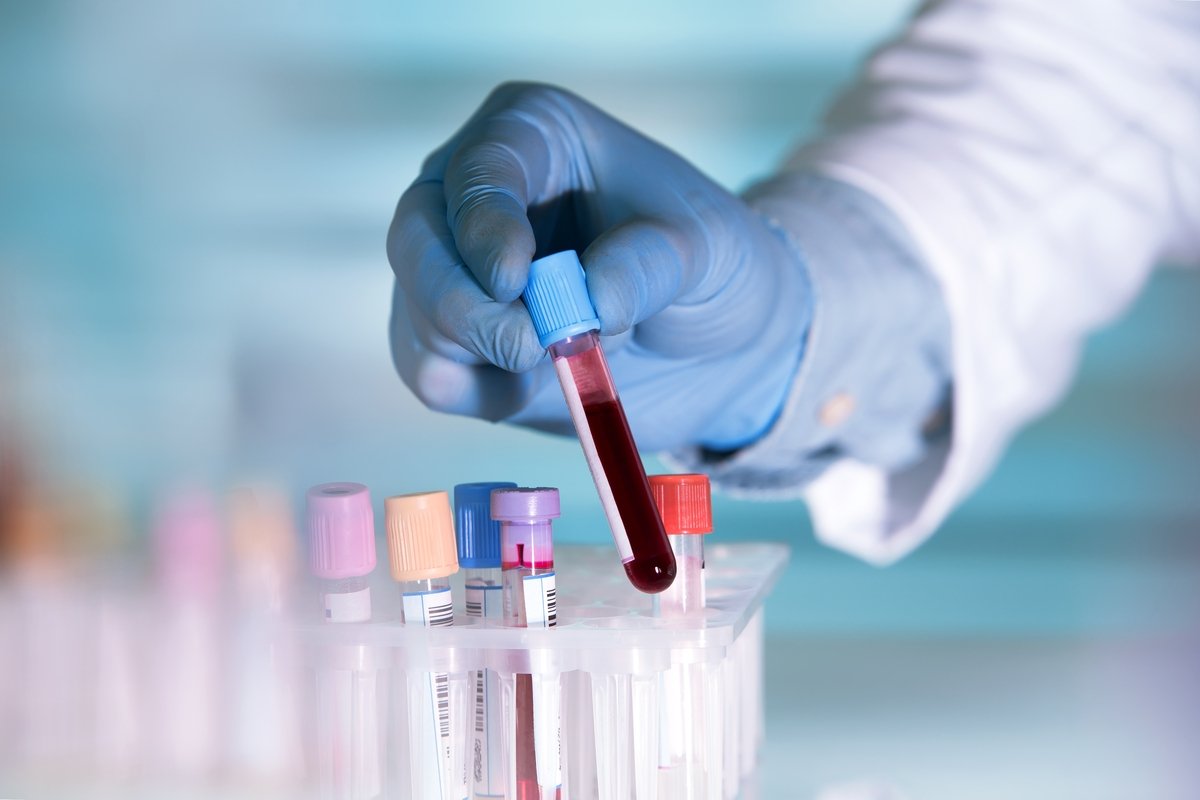 12 tes darah: bagaimana memahami hasilnya_0