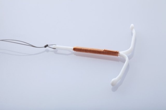 IUD Tembaga: apa itu, cara kerjanya dan kemungkinan efek sampingnya_0