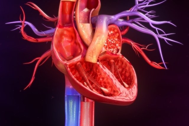 5 penyakit jantung utama pada lansia_1