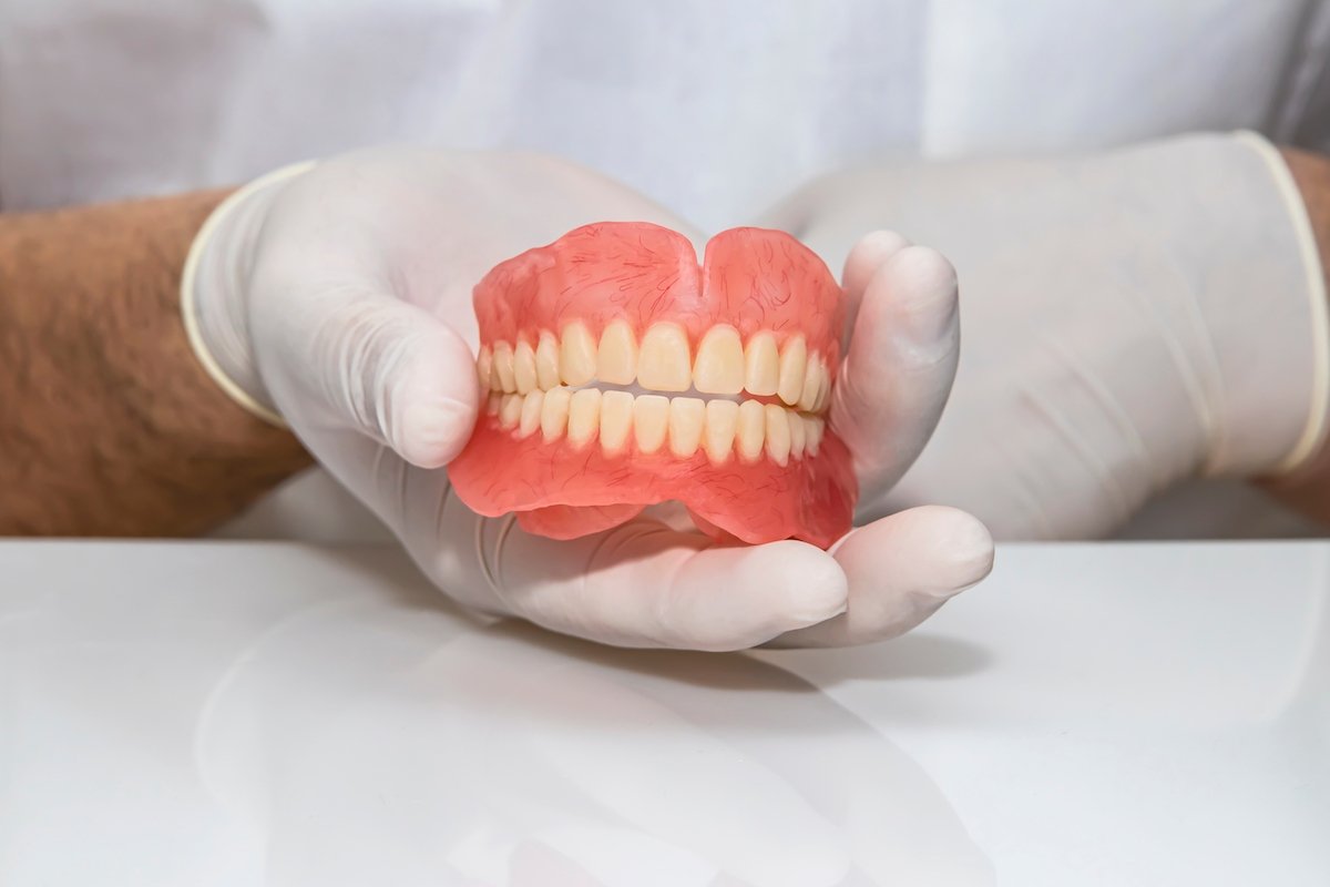 Prostesis gigi: apa itu, jenis, kapan digunakan dan dirawat_0