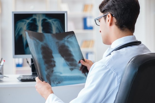 Emboli paru: apa itu, gejala, penyebab dan pengobatan_1